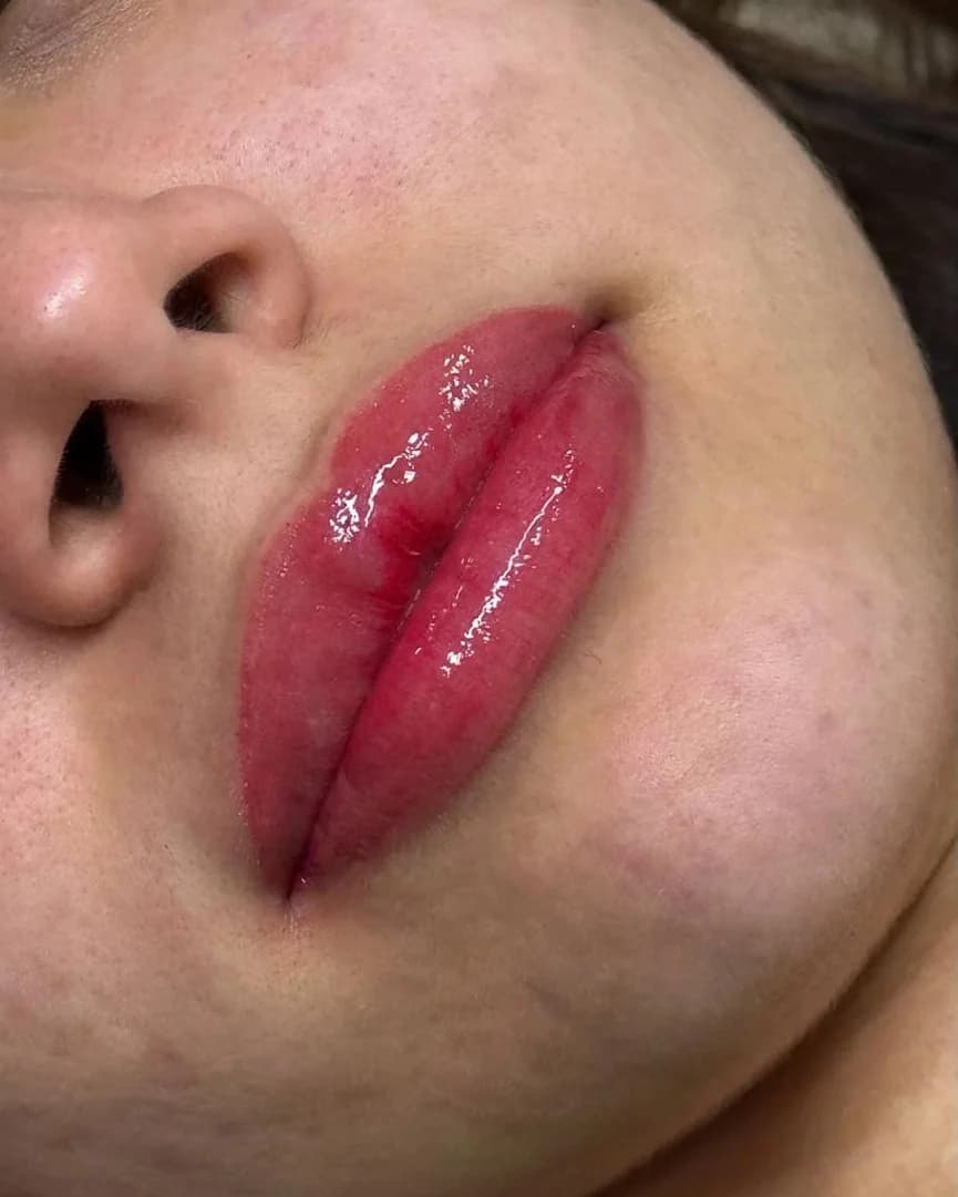 Close de lábios com a cor realçada em rosa, depois da revitalização labial.